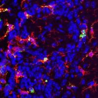 Activated microglia in the olfactory bulb after multiple GAS infections